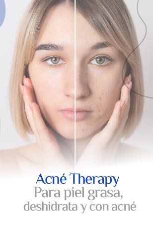 Acquagraph-Acne-therapy